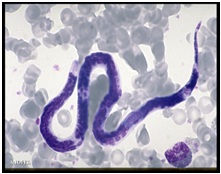 Loase à loa- loa: épidémiologie,Diagnostic et Traitement