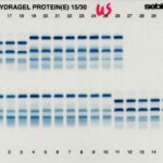 METHODES ELECTROPHORETIQUES : PRINCIPE, APPAREILLAGE ET APPLICATION EN DOMAINE MEDICALE