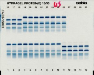 METHODES ELECTROPHORETIQUES : PRINCIPE, APPAREILLAGE ET APPLICATION EN DOMAINE MEDICALE