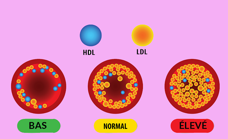 Les lipoprotéines cholésterol HDL, Triglycérides biologie médicale