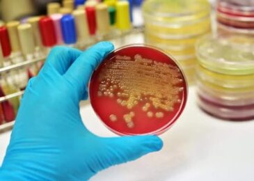 La coproculture : Mode opératoire